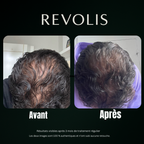 Revolis Full Growth Kit